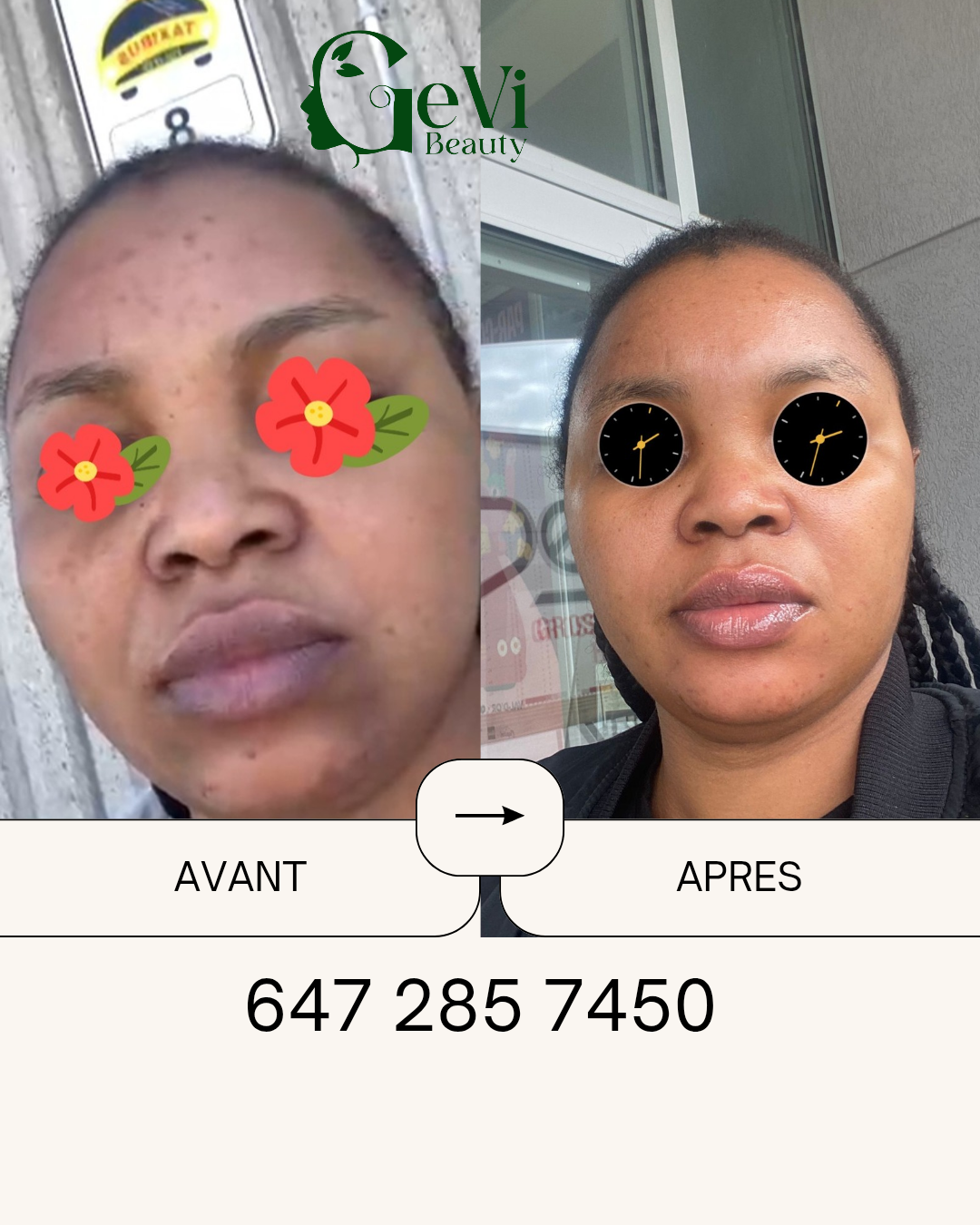 GLOW SUPREME Kit Visage(teint terne et hyperpigmentation/ Face Kit (dull skin and hyperpigmentation)