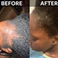 Hair Growth Elixir - GeVi Beauty 