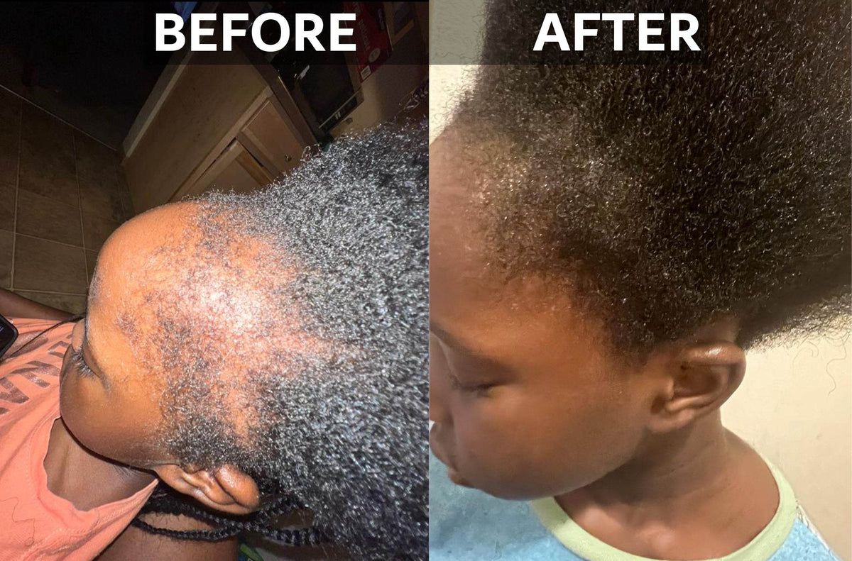 Hair Growth Elixir - GeVi Beauty 